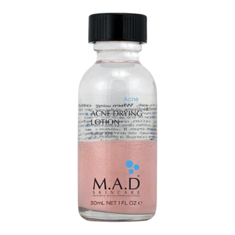 M.A.D SKINCARE ACNE DRYING LOTION W SUFUR 10%